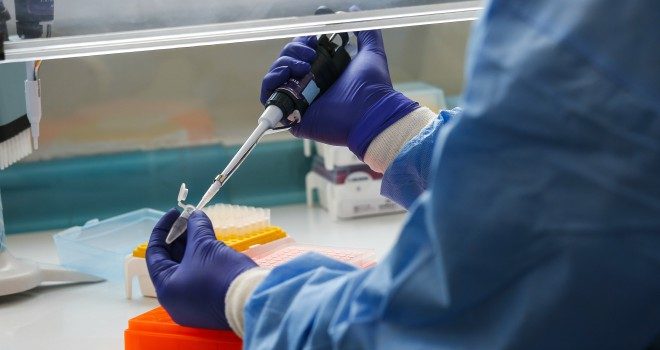 Confirman caso de infección por variante Delta en la Región de Los ...